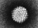 Das Papilloma Virus wird allgemein als Verursacher des Karzinoms angesehen.