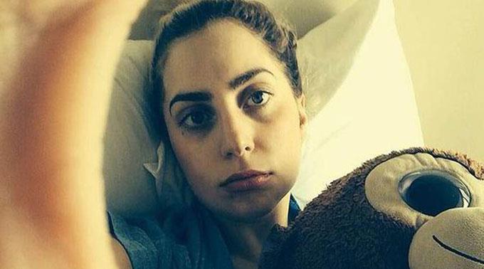 Lady Gaga postete ein Foto von sich nachdem ihr Weisheitszahn gezogen wurde.